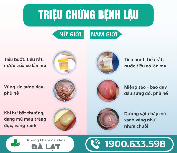 Hình ảnh minh họa